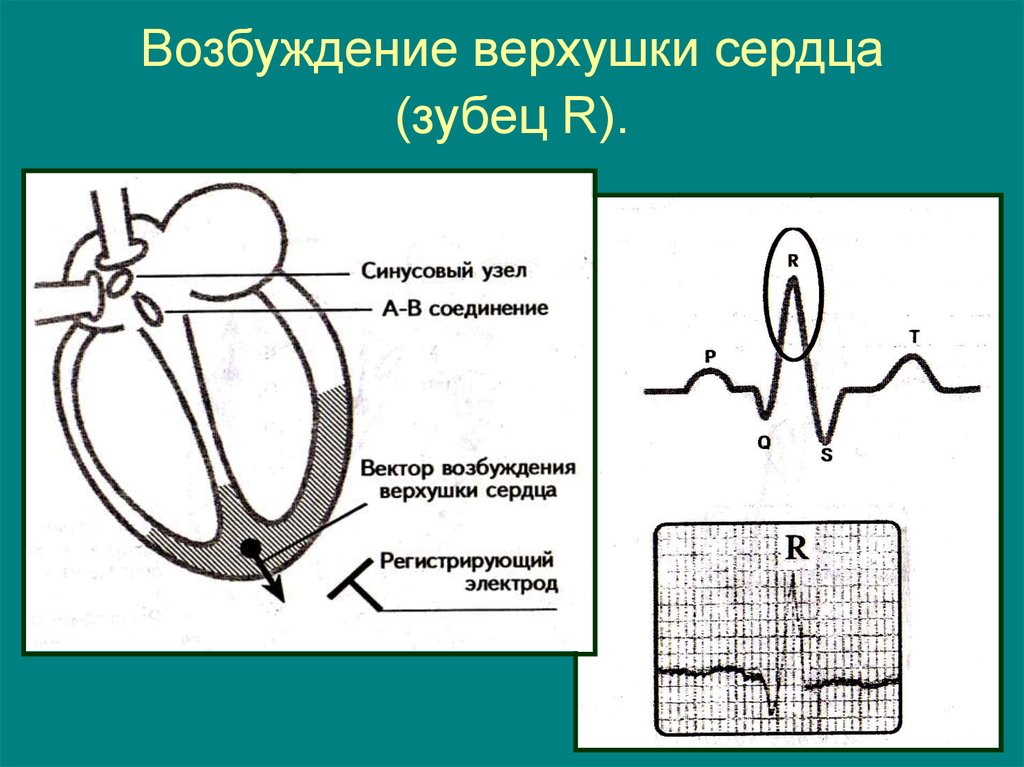 Возбуждение сердца. Распространение возбуждения в сердце ЭКГ. Верхушка сердца. Возбуждение сердца на ЭКГ. Зубцы сердца.