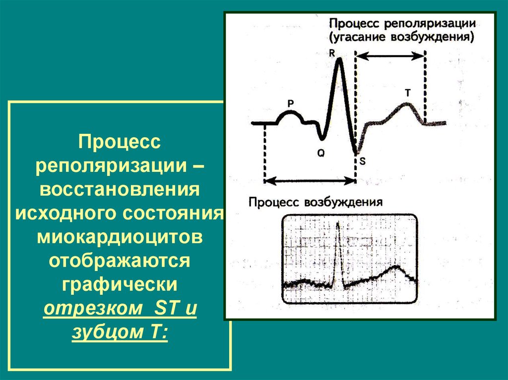 Реполяризация на экг что значит