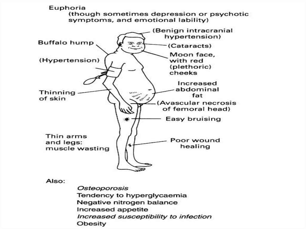 omniplan what does s to s dependency mean