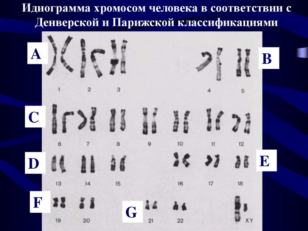Хромосом группы d. Кариотип классификация хромосом. Кариотип человека Денверская классификация хромосом. Идиограмма хромосом. Кариотип и идиограмма хромосом человека.