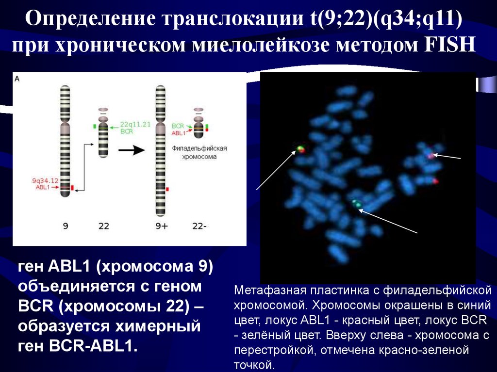 Хромосомные мутации методы генетики. Хронический миелолейкоз цитогенетика. Хромосомные транслокации. Цитогенетический метод хромосомы. Транслокация 9 и 22 хромосомы.