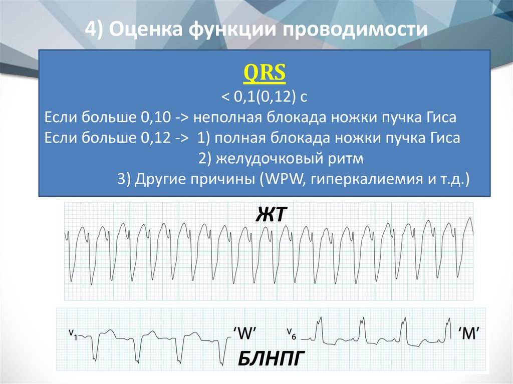 Оценить функцию. Оценка функции проводимости. Оценка функции проводимости на ЭКГ. Оценка функции проводимости сердца. Оценка функциональной проводимости ЭКГ.