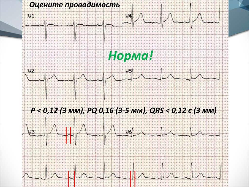 Норма экг время