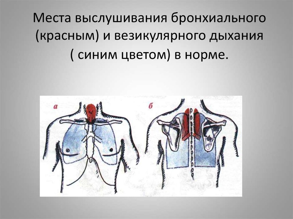 Схема аускультации легких