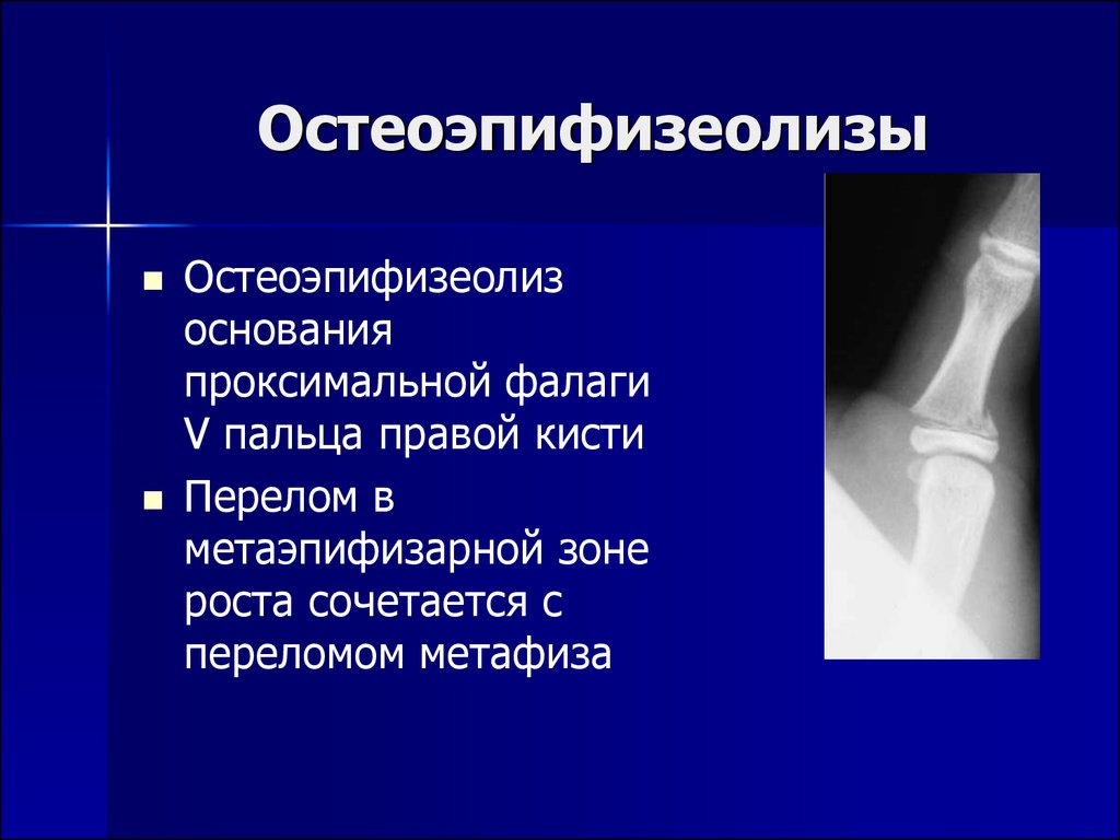 Проксимальной слабости