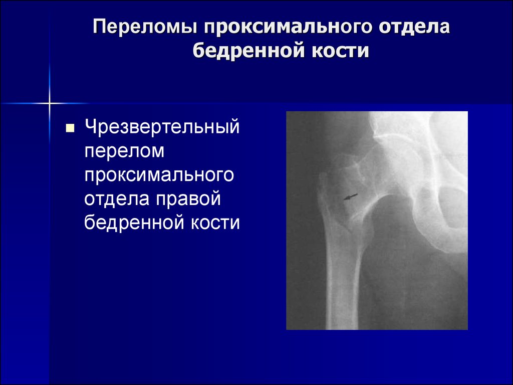 Лучевая диагностика костей презентация