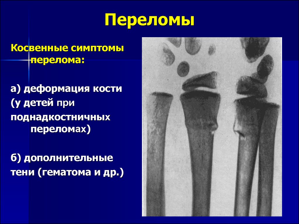 Лучевая диагностика костей презентация