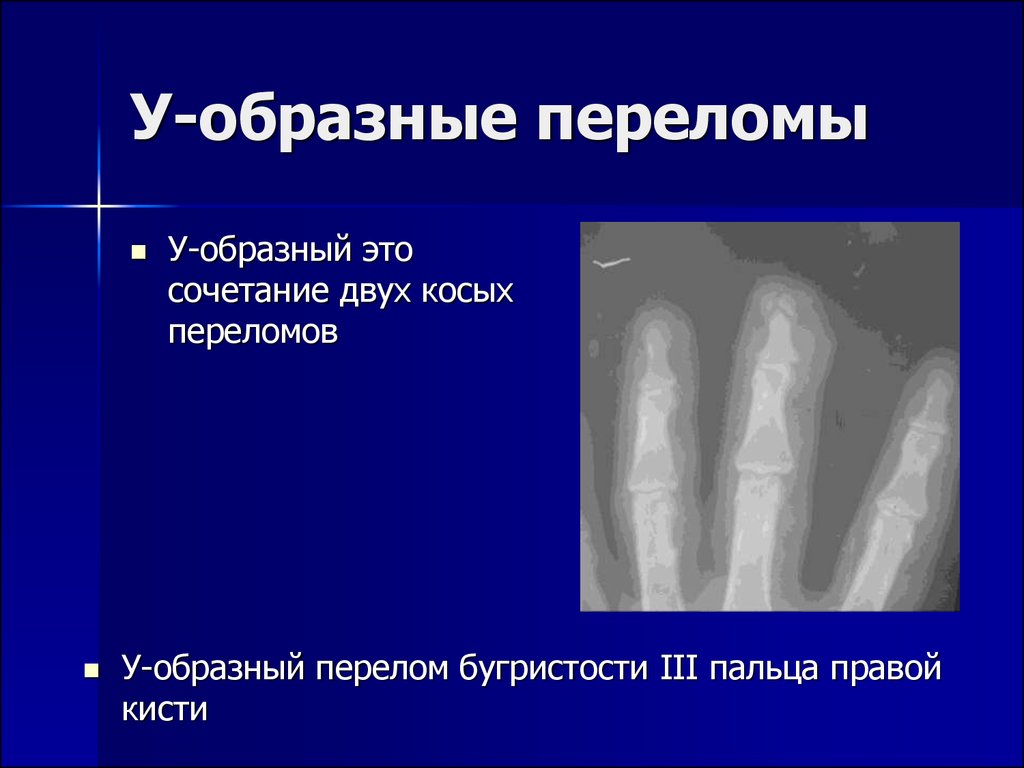 Лучевая диагностика костей презентация