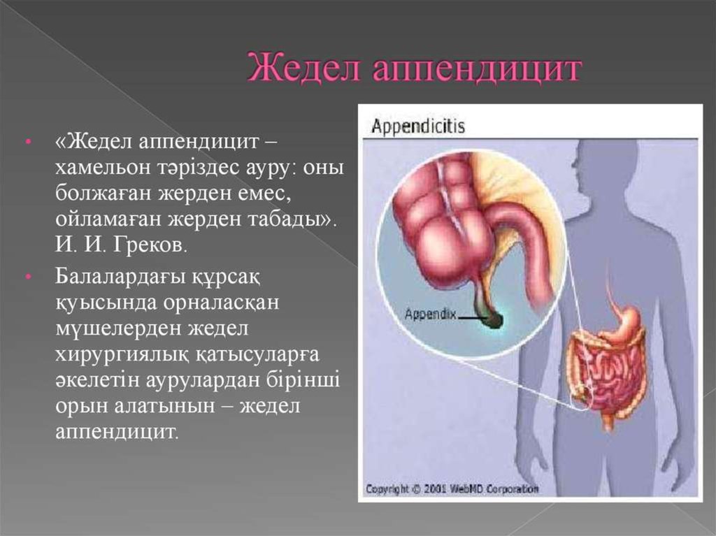 Хронический аппендицит презентация