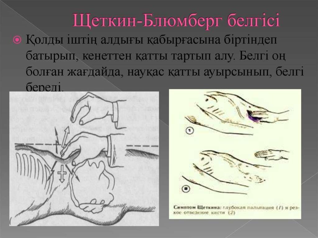 Аппендицит презентация госпитальная хирургия