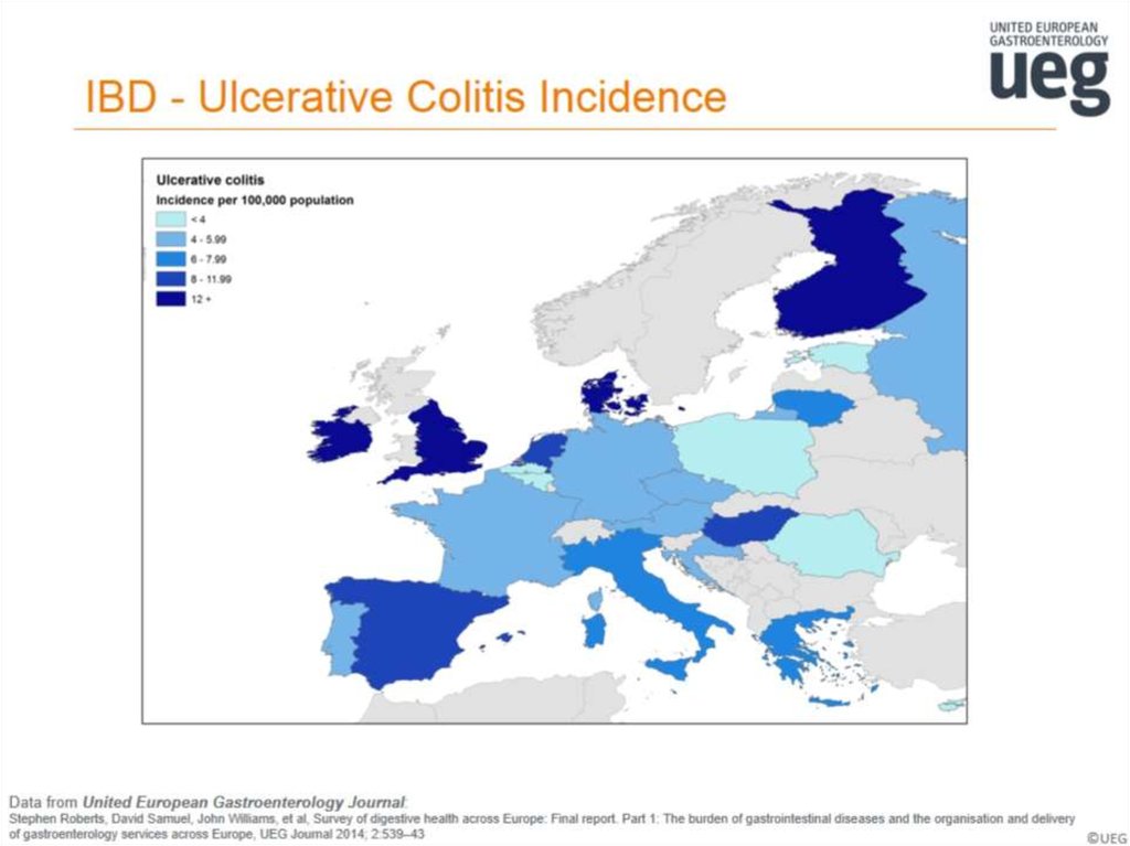 IBD - Ulcerative Colitis Incidence