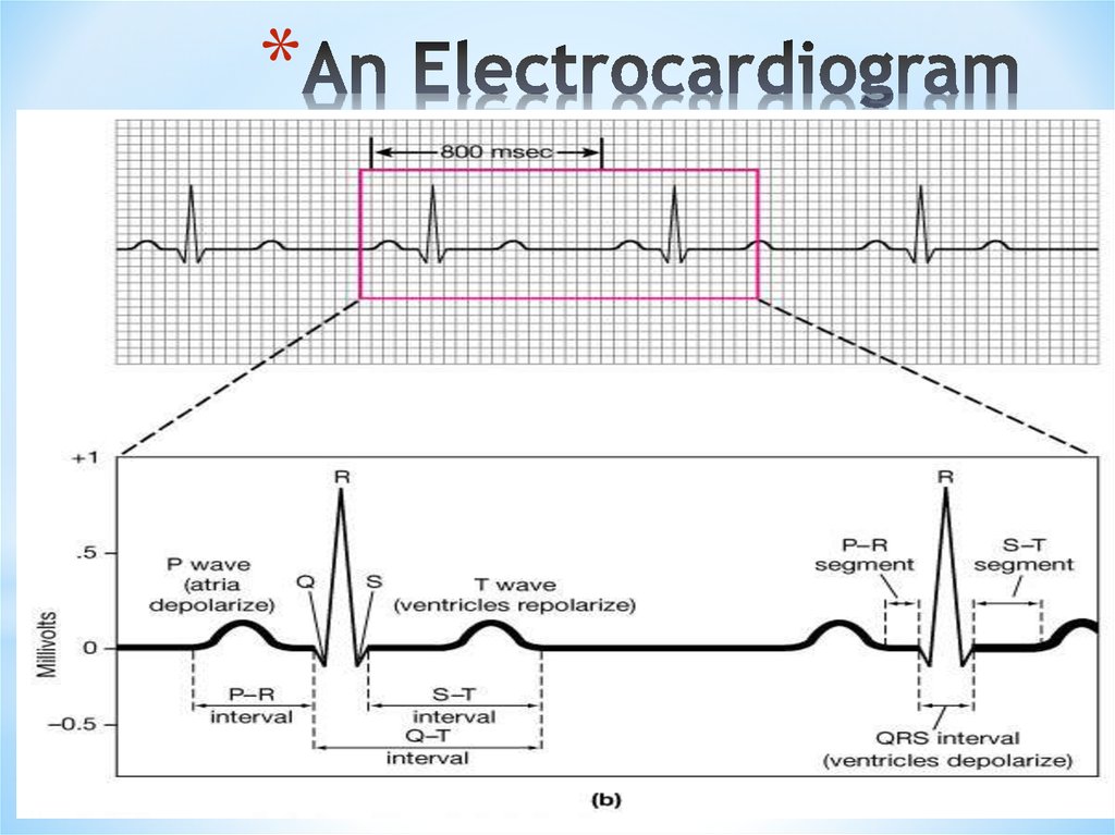 An Electrocardiogram