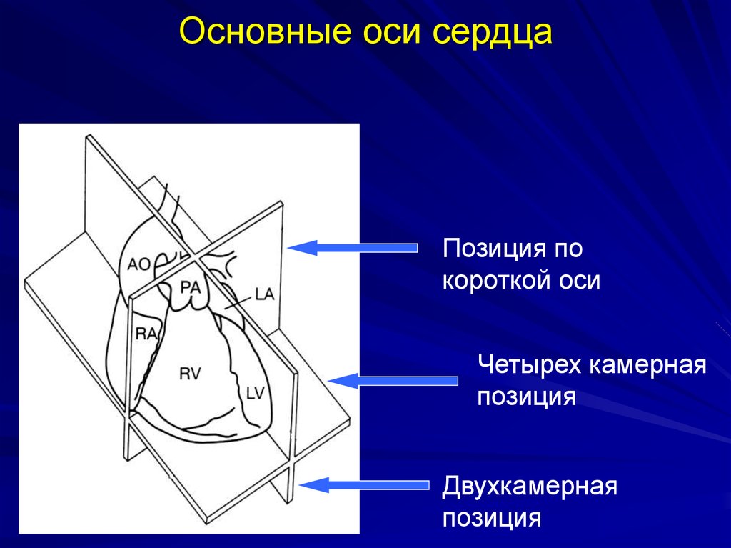 Размеры полости. Длинная ось сердца. Проекция оси сердца. Короткая ось сердца. Ось сердца анатомия.