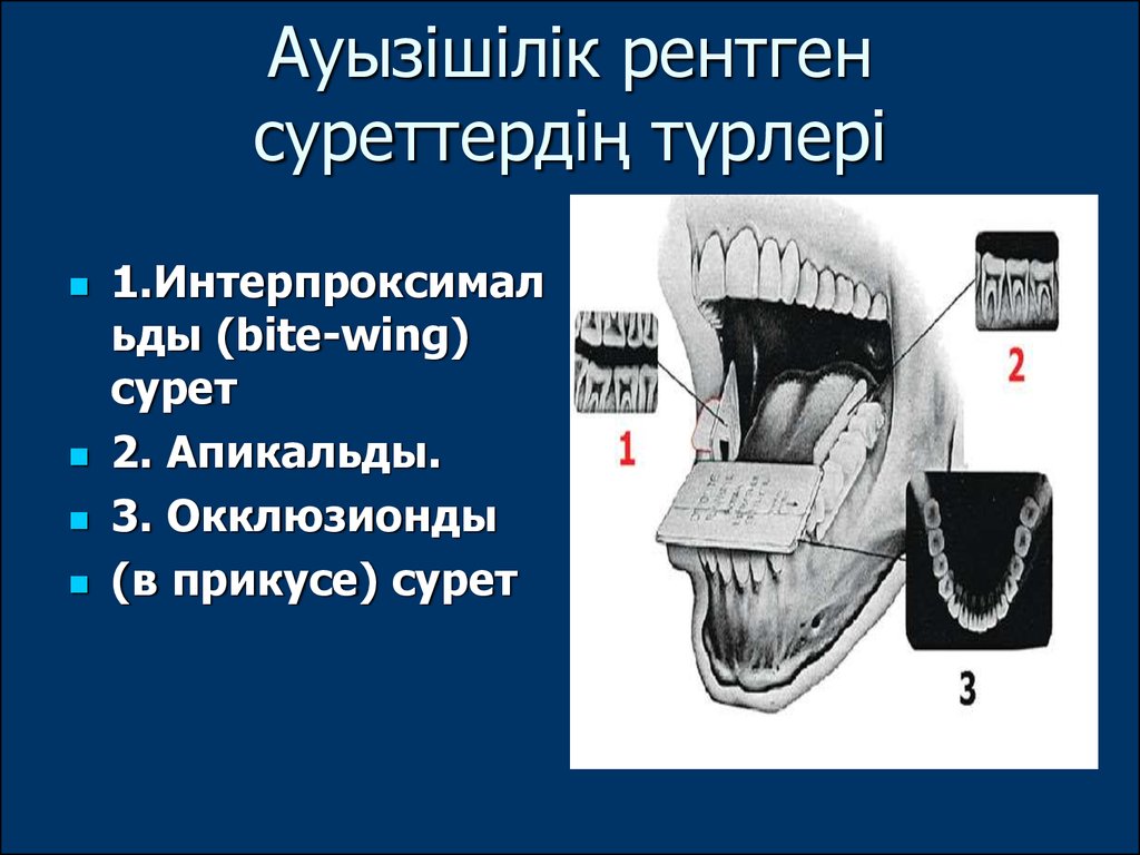 Рентгена 5 карта