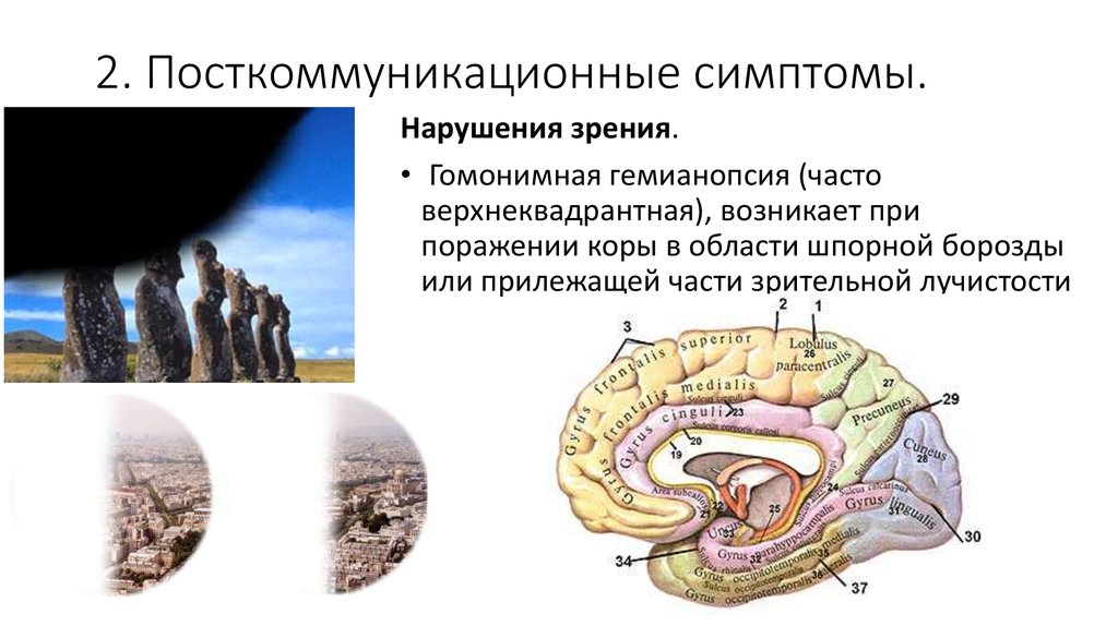 2. Посткоммуникационные симптомы.