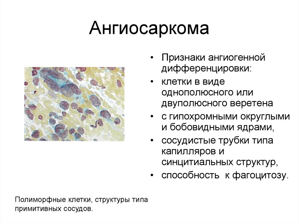 Полиморфная клиническая картина это