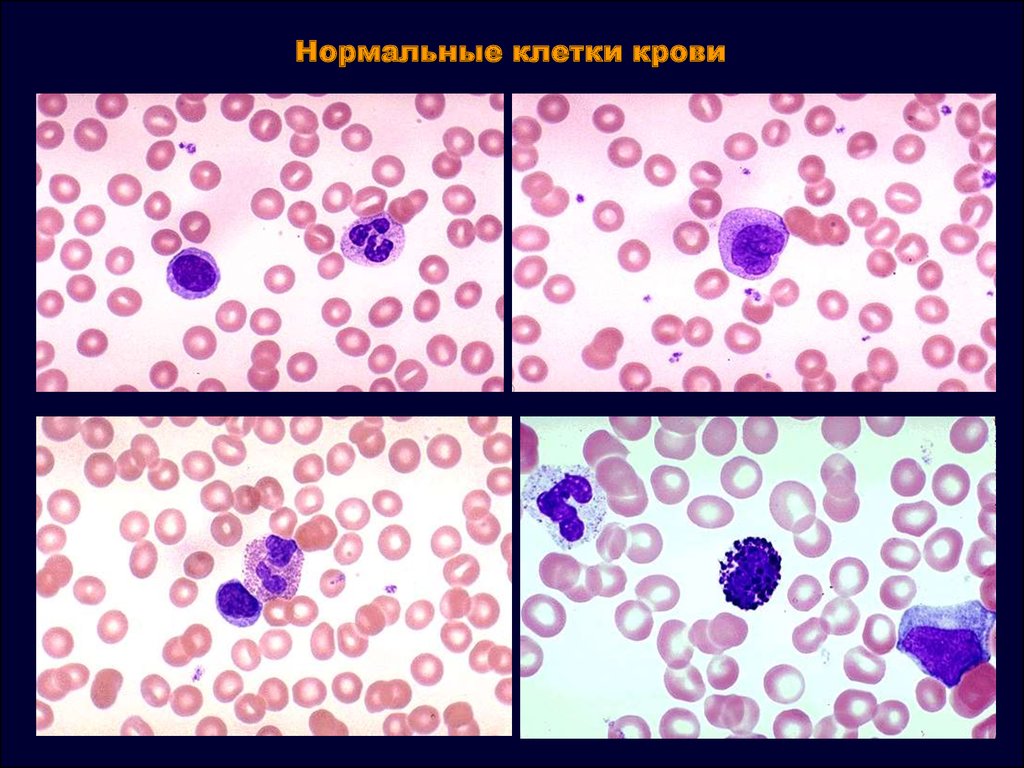 Нормальная клетка. Нормальные клетки крови. Как выглядят клетки крови. Нормальная клетка человека.