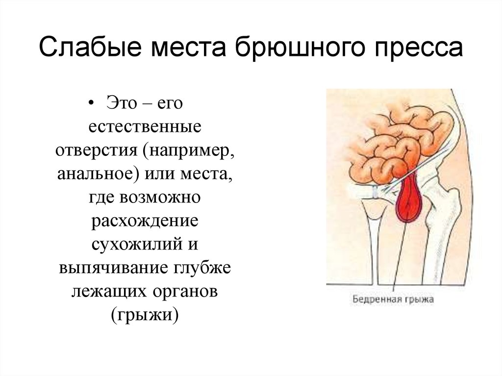 Слабые места. Слабые места брюшного пресса. Слабые места мышц живота. Слабые места мышц живота анатомия.