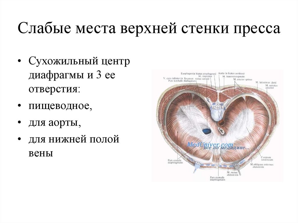 Слабые стенки. Пояснично реберный треугольник диафрагмы. Слабые места диафрагмы топографическая анатомия. Слабые места диафрагмы (Diaphragma):. Слабые места живота анатомия схема.