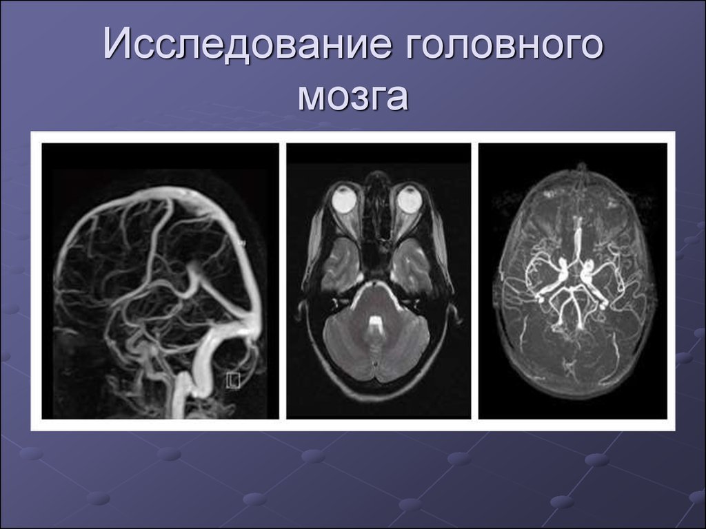 Исследование головного мозга