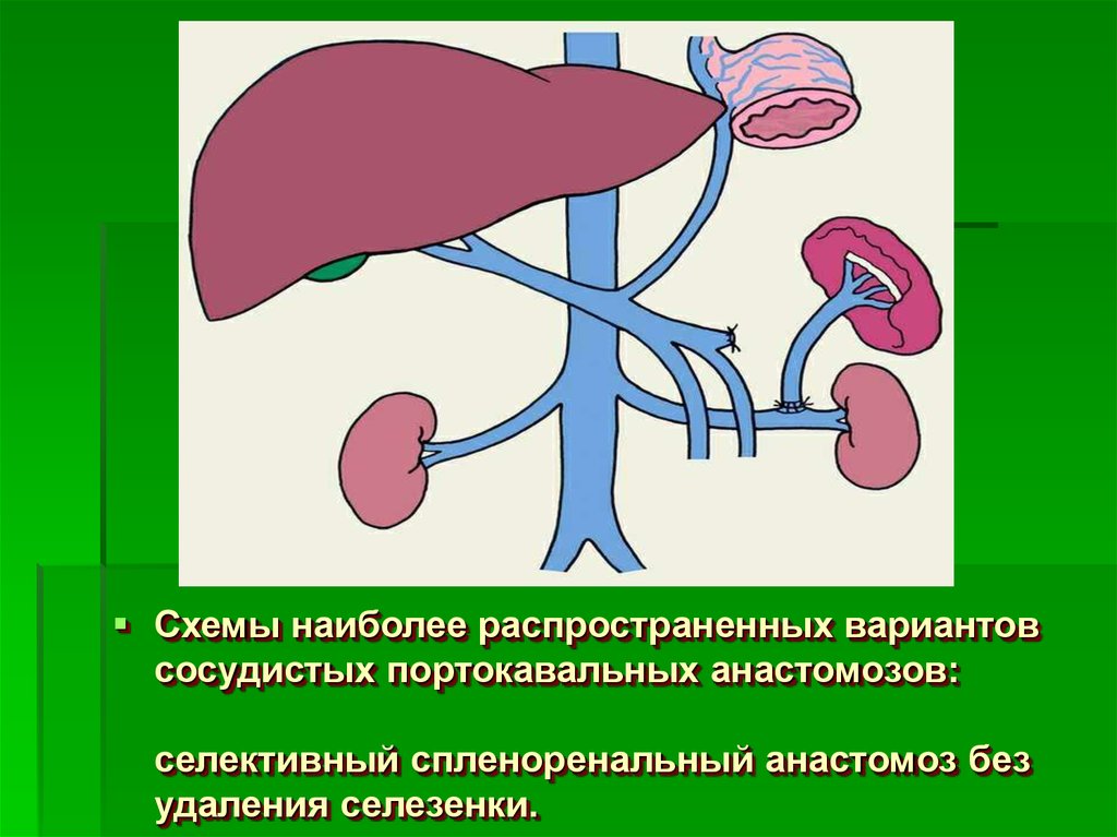 Усиление сосудистого портального рисунка печени у ребенка что это