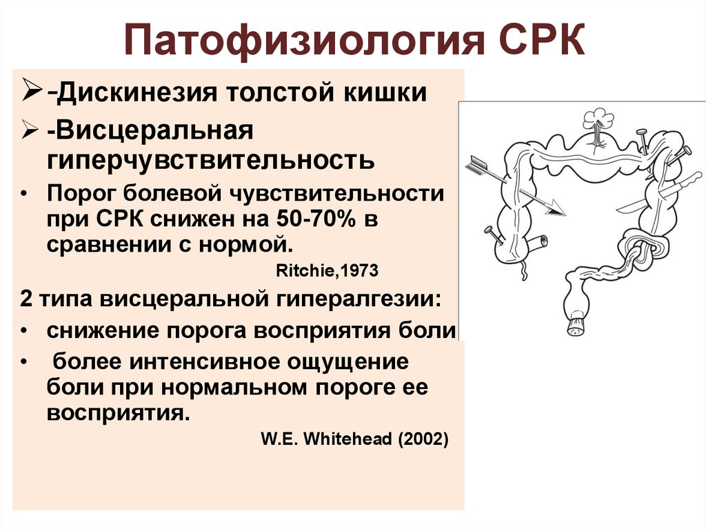 Синдром раздраженной толстой кишки презентация