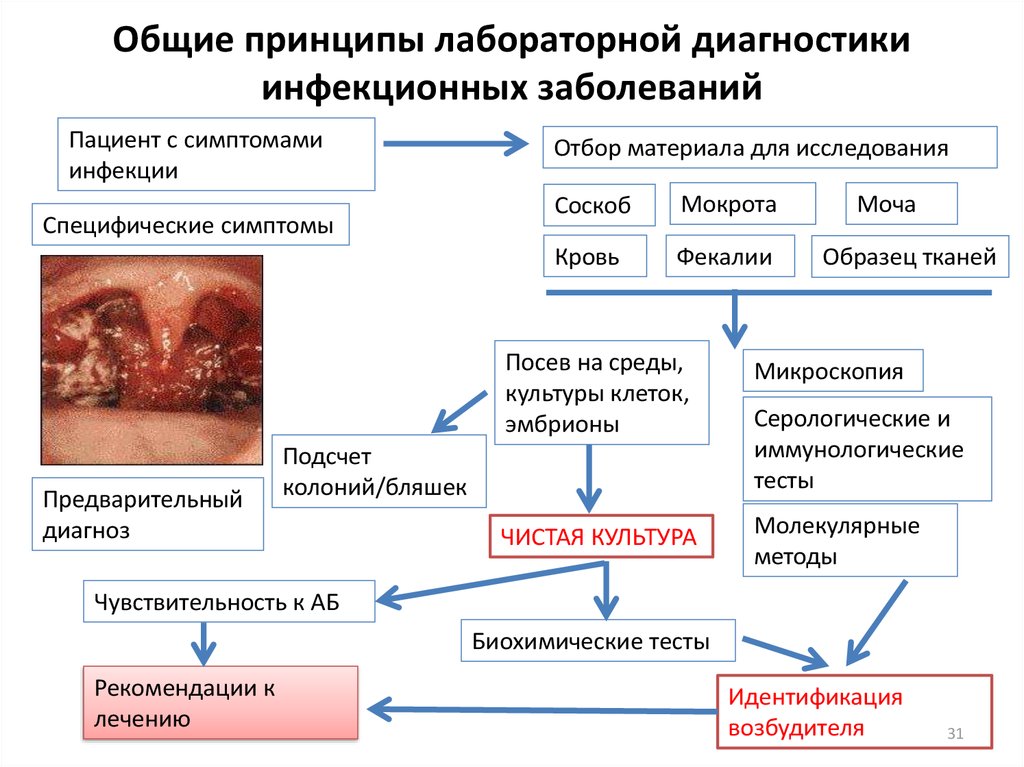 Общая схема лабораторной диагностики инфекционных заболеваний бактериальной этиологии