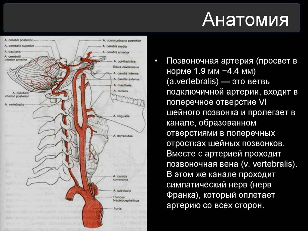 Кровоснабжение межпозвоночных дисков. Синдром позвоночной артерии с4. Анатомический стеноз позвоночной артерии. V3 сегмент позвоночной артерии. Сегменты v3 v4 позвоночной артерии.