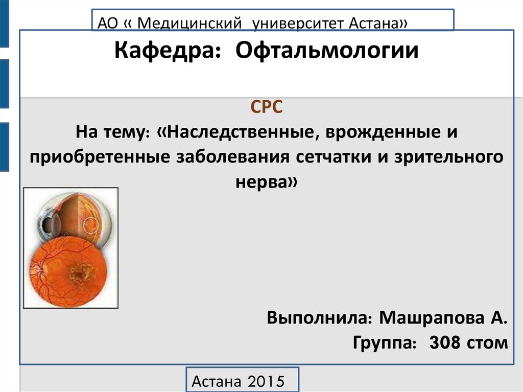 Заболевания сетчатки и зрительного нерва презентация