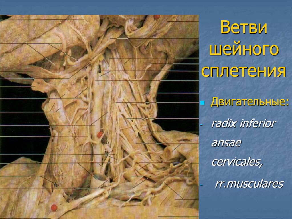 Сплетение черепных нервов. N hypoglossus анатомия. Шейное сплетение нервы анатомия. Шейное и плечевое сплетение спинномозговых нервов. Шейное сплетение анатомия препараты.