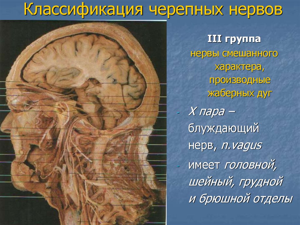 10 черепной нерв. Черепные нервы классификация. Группы черепных нервов. Классификация черепных нервов. III Черепные нервы.
