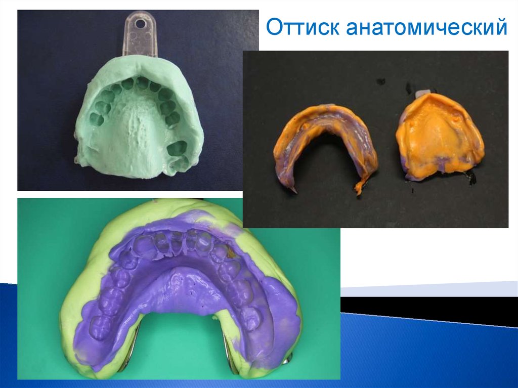 Изображение полученное путем оттиска