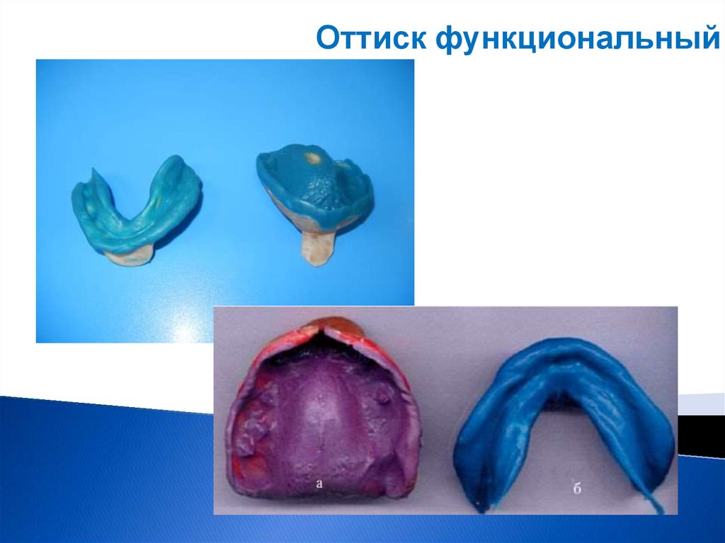 Слепочные материалы в стоматологии презентация