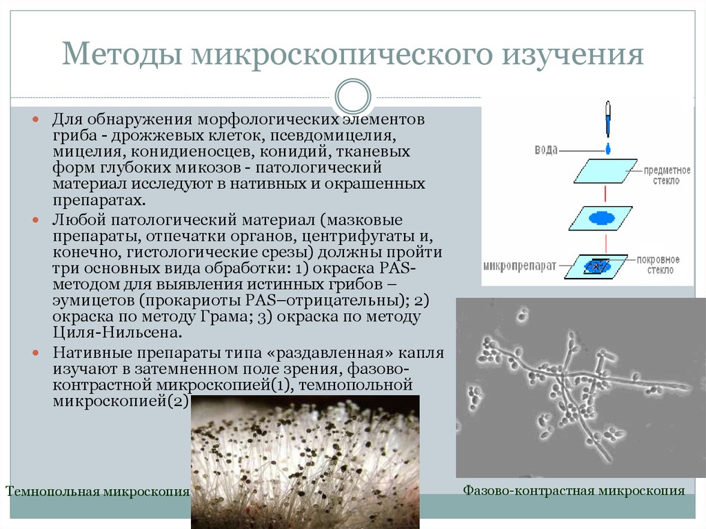 Микроскопией называют метод микроскопии. Мицелий гриба микроскопия. Микроскопические грибы микроскопия. Методы изучения грибов в световом микроскопе. Методы изучения микроскопических грибов и актиномицетов.