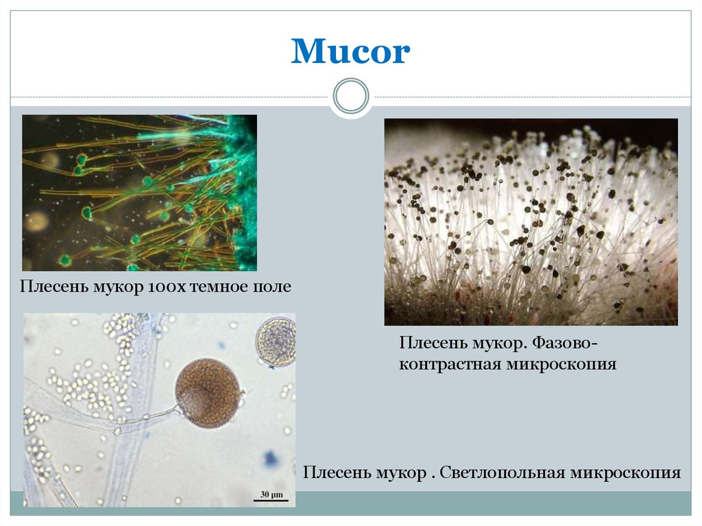 Мукор одноклеточный. Мукор синцитий. Плесневые грибы рода Mucor. Микроскопические грибы микроскопия. Мукор колонка.