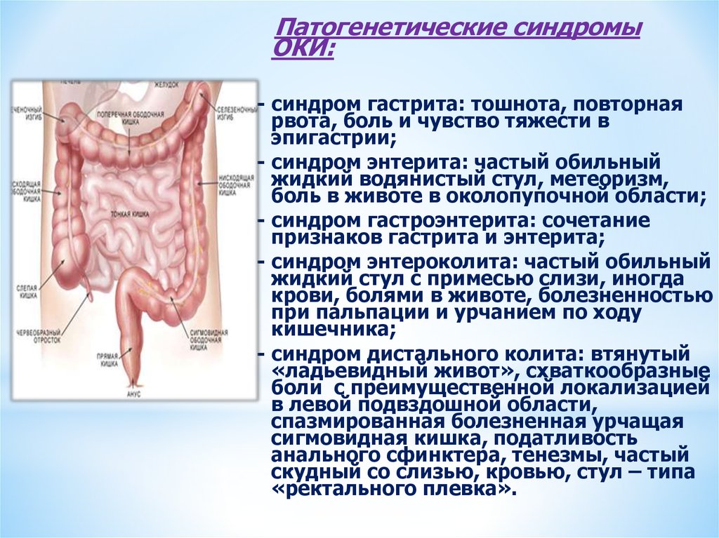 Боль в сигмовидной кишке причины. Сигмовидная кишка при пальпации. Синдромы при гастрите. Спазмированная сигмовидная кишка.