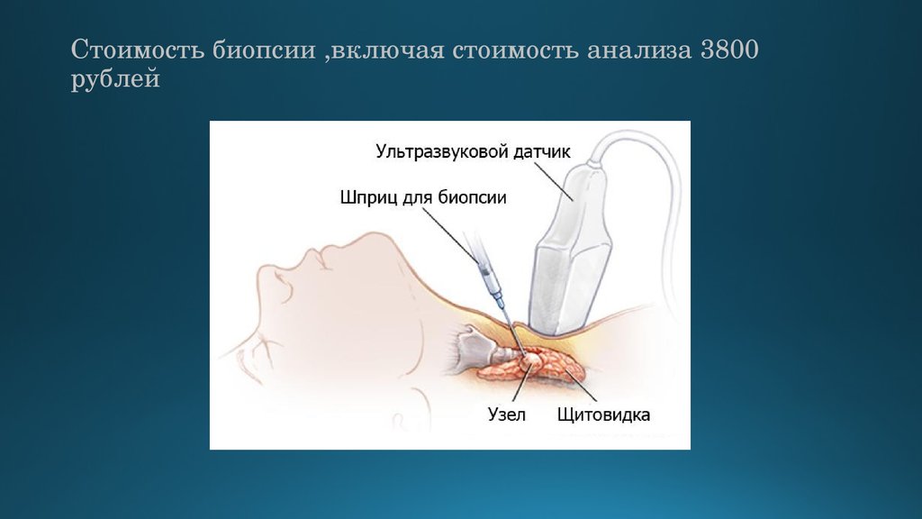 Что такое биопсия. Реферат на тему «медицинский центр» pdf. Биопсия стоимость в Москве.