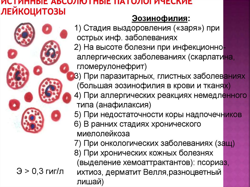 Абсолютный лейкоцитоз. Заболевания лейкоцитов в крови. Эозинофилия при паразитарных заболеваниях. Лейкоцитоз при аллергических реакциях. Эозинофильный лейкоцитоз.