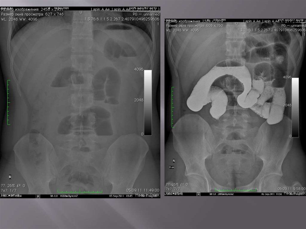 Лучевая диагностика брюшной полости презентация