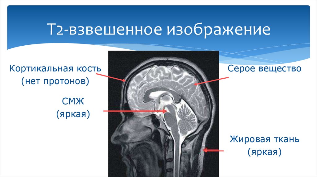 Т1 т2 взвешенное изображение