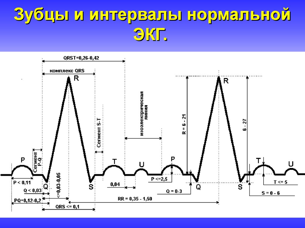 Экг рисунок с обозначениями