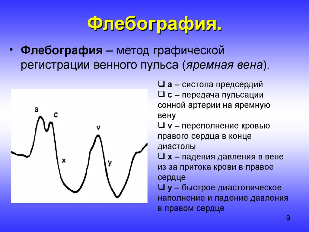 Графическое изображение динамики пульса