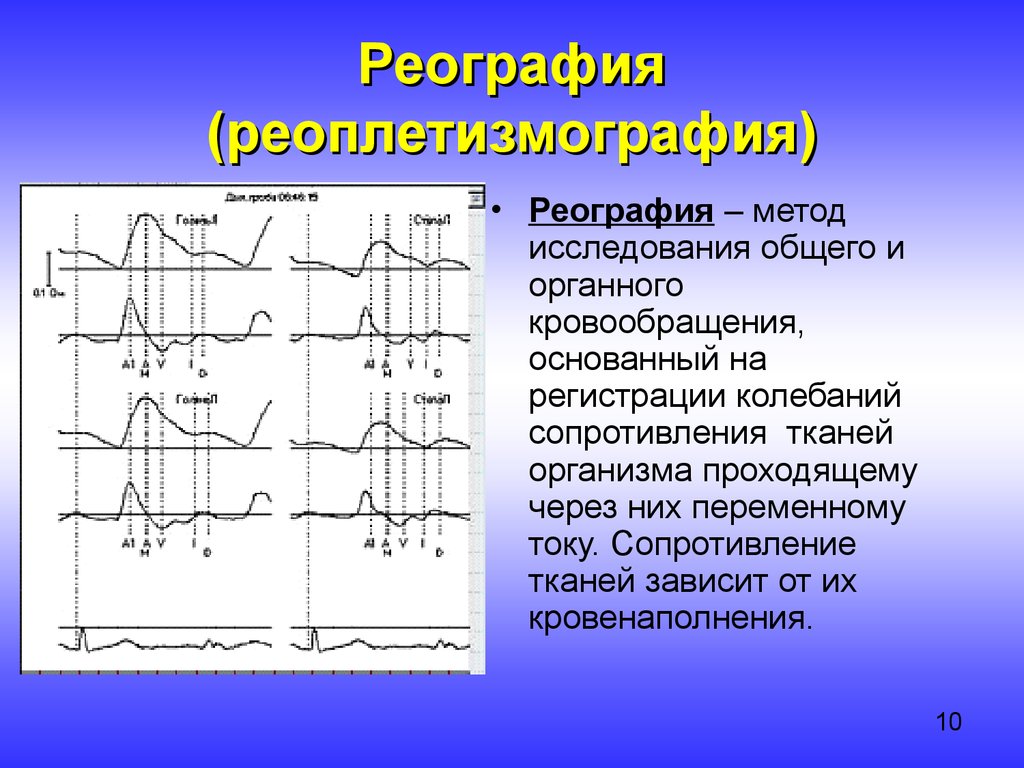 Метод нс. Реография. Реограммы.. Методы исследования сосудов реография. Метод импедансной реоплетизмографии. Интегральная реография сердца.