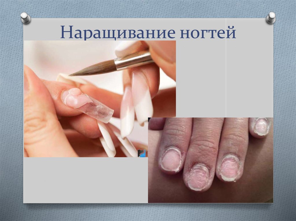 Наращивание ногтей