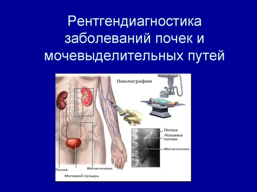 Инструментальные методы исследования мочевыделительной системы презентация