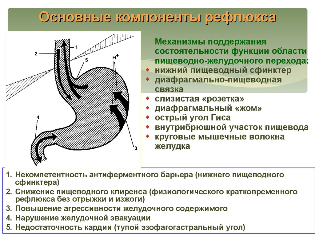 Фарингит на фоне рефлюкса