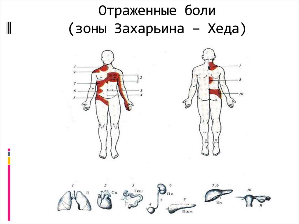 Захарьина тесты. Отраженные боли. Отраженные боли зоны Захарьина. Отраженная боль в зоне Захарьина-Геда. Иррадиация боли зоны Захарьина.