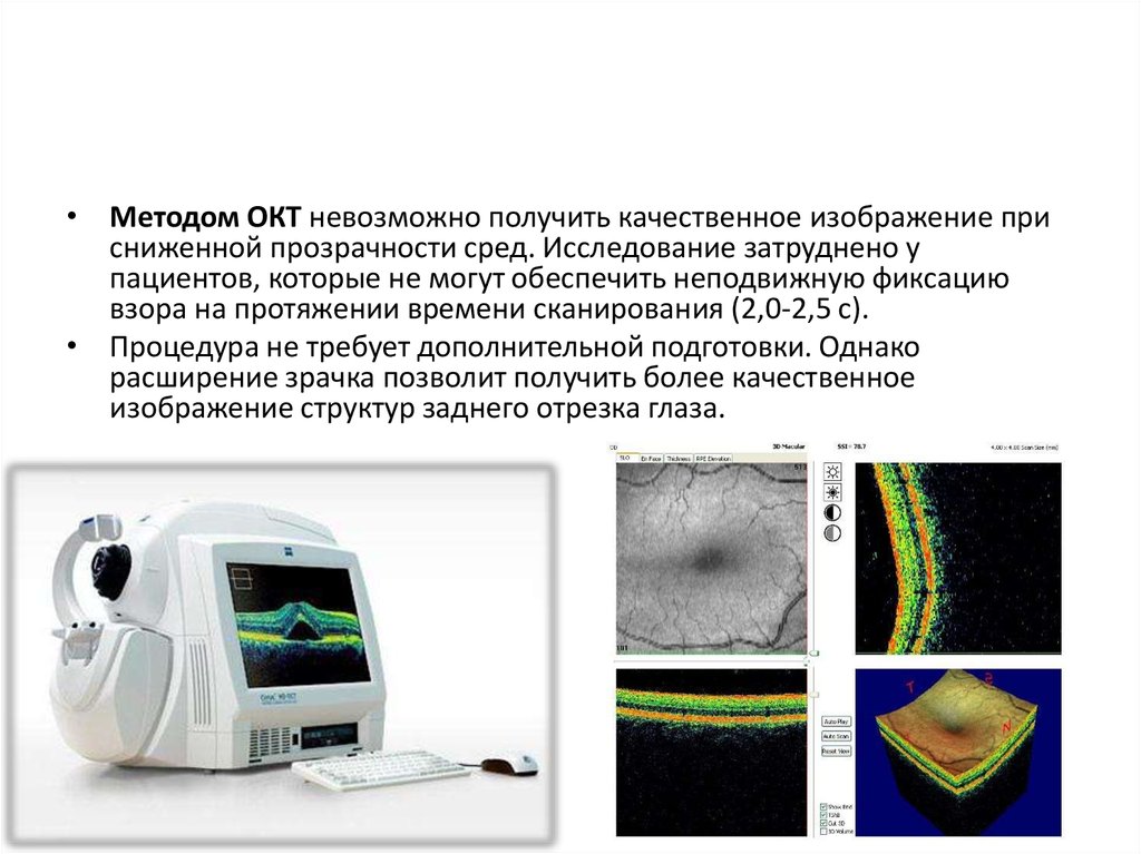 Оптическая когерентная томография схема