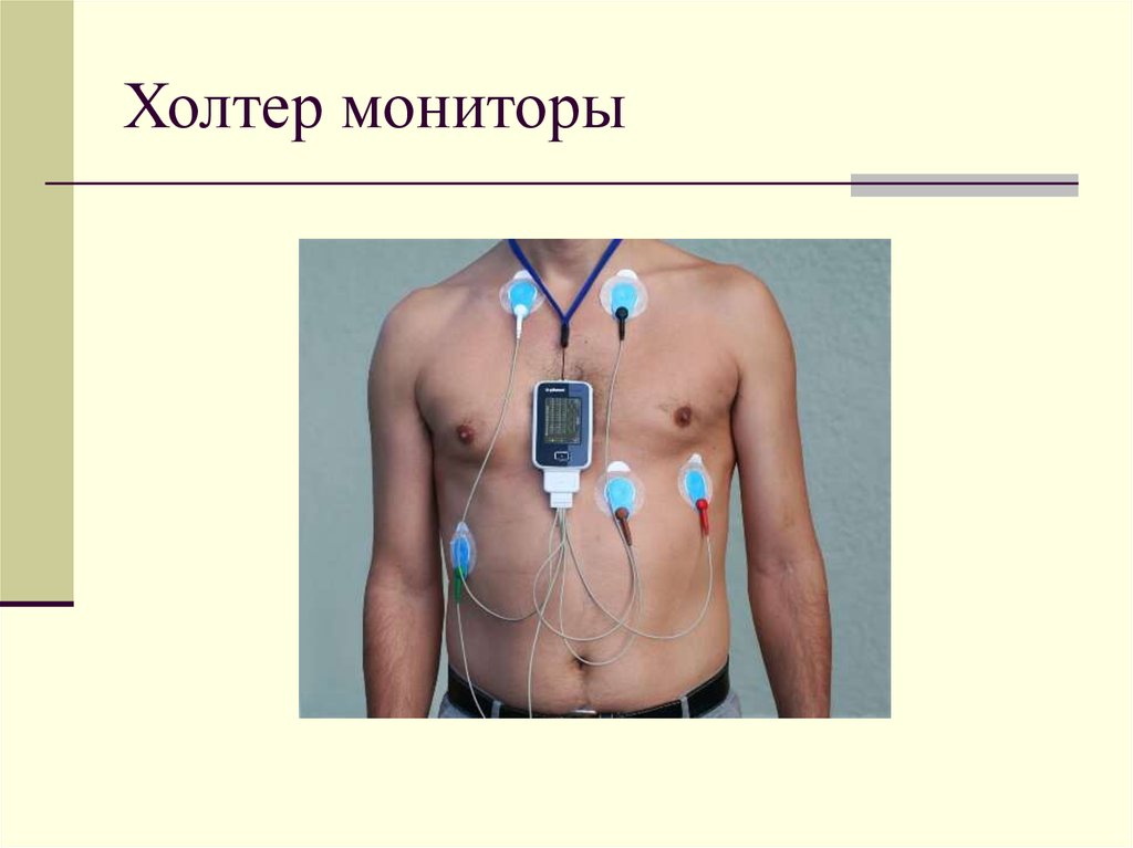 Как узнать работает ли холтер монитор