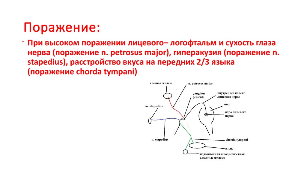 Поражение это